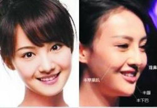 明星整形吃瓜爆料视频